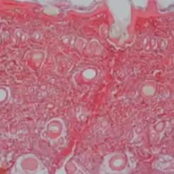 After Polynucleotides 1