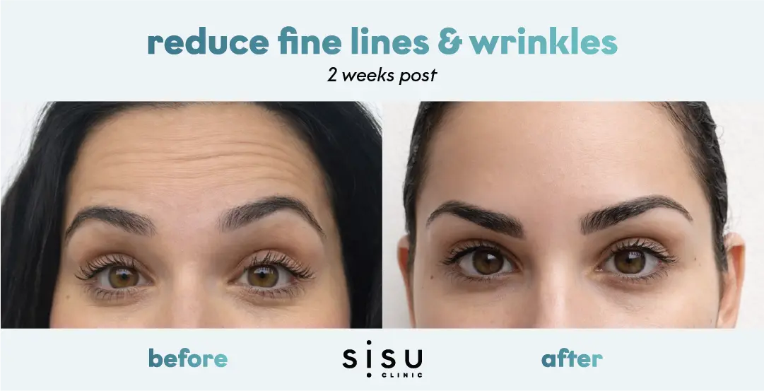Sisu Clinic USA